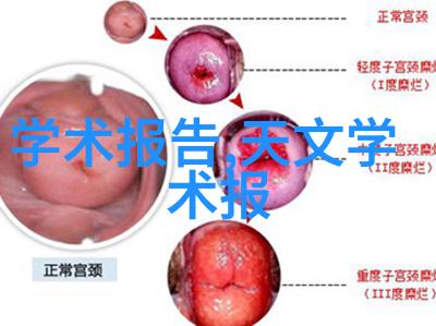 如何运用小光圈让每一帧照片都成为画廊级展品