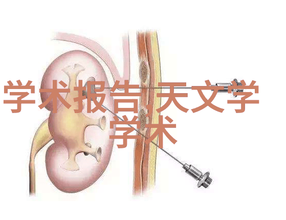 不锈钢丝网填料参数优化技术研究